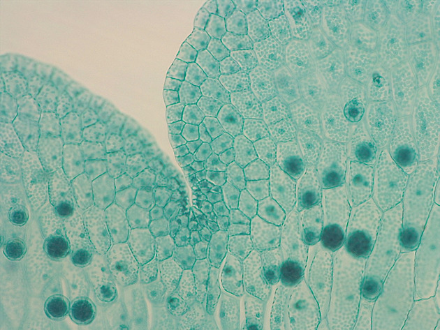 Fern Gametophyte Slides - Ferngametophyte 04 200X